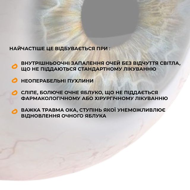 евісцерація або енуклеація - видалення ока